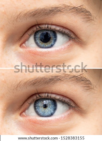Blue human eyes dilated and constricted close up