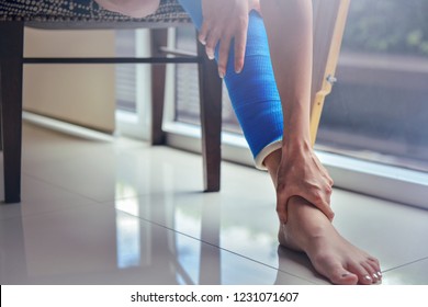 Blue Splint Knee. Bandaged Leg Cast And Toes After A Running Injury Accident.Young Woman In Blue Plaster Cast. Cropped Shot Of A Girl Holding Her Leg In Pain. Shin Splints.