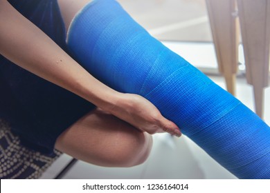 Blue Splint Knee. Bandaged Leg Cast And Toes After A Running Injury Accident.Young Woman In Blue Plaster Cast. Cropped Shot Of A Girl Holding Her Leg In Pain. Shin Splints.