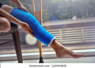 Blue Splint Knee. Bandaged Leg Cast And Toes After A Running Injury Accident.Young Woman In Blue Plaster Cast. Cropped Shot Of A Girl Holding Her Leg In Pain. Shin Splints.
