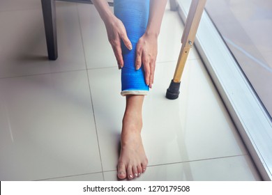 Blue Splint Knee. Bandaged Leg Cast And Toes After A Running Injury Accident.Young Woman In Blue Plaster Cast. Cropped Shot Of A Girl Holding Her Leg In Pain. Shin Splints.