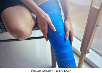 Blue Splint Knee. Bandaged Leg Cast And Toes After A Running Injury Accident.Young Woman In Blue Plaster Cast. Cropped Shot Of A Girl Holding Her Leg In Pain. Shin Splints.