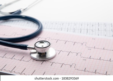 Blue Stethoscope On Electrocardiogram (ECG) Chart Paper. ECG Heart Chart Scan Isolate On White. Healthcare Insurance And Medical Background 