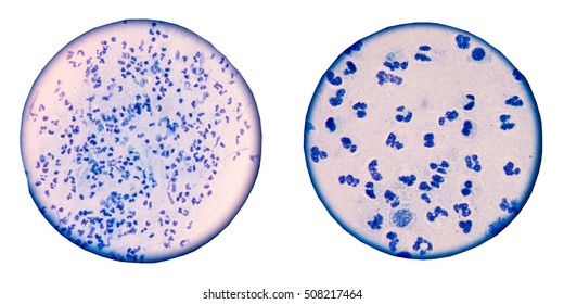 57 Colonies mycobacterium tuberculosis Images, Stock Photos & Vectors ...