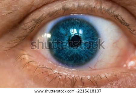 a blueeye close-up from side