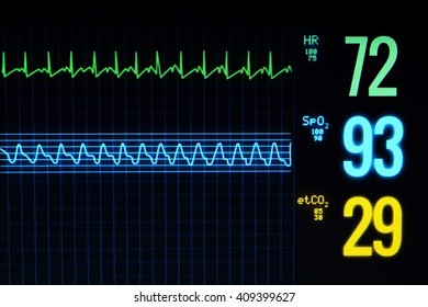 Blur Electrocardiography Monitor