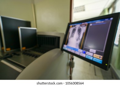 Blur image of chest x-ray on Computed Radiography(CR) station, Medical concept