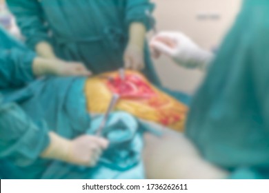 372 Excision Tumors Images, Stock Photos & Vectors | Shutterstock