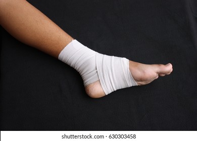 Blurry Of Ankle Splint, Be In Plaster Cast.Injured Female Hand With Upper Part Of Body. Ankle Is Bandaged With Plaster.