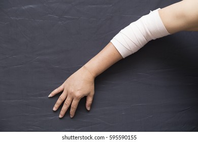 Blurry Of Arm Splint, Be In Plaster Cast.Injured Female Hand With Upper Part Of Body. Hand Is Bandaged With Plaster.