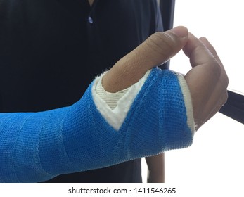 Blurry Of Arm Splint.be In Plaster Cast. Injured Man Hand With Upper Part Of Body. Hand Is Bandaged With Plaster.