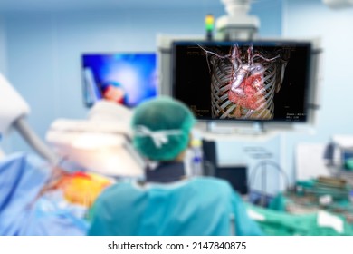 Blurry Close Up Heart Surgeon Doctor Operation Heart Surgery Showing On Monitor Intervention Close-up Replace Valve Open Cord Surgery Minimally Invasive Surgery, Medical Health Concept.