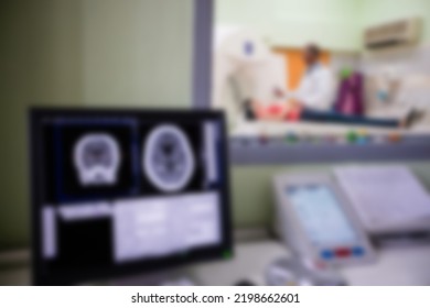 Blurry Digital Brain Scan On Computer Monitor