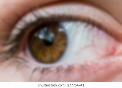 Blurry Eye Close Up. Concept Of Bad Vision.