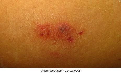 7,630 Rotting skin Images, Stock Photos & Vectors | Shutterstock