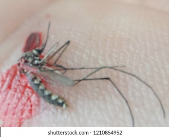 Blurry Image,Mosquito Hit The Slap Until Death. And Blood On The Surface Of People.