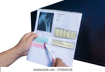 (BMD) DEXA densitometry hip scan. Osteopenia present, frequent precursor to osteoporosis on pen point on white background.Medical healthcare concept. - Shutterstock ID 1733642126