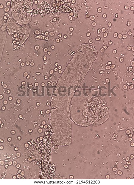 5 Board Waxy Cast Images, Stock Photos & Vectors | Shutterstock