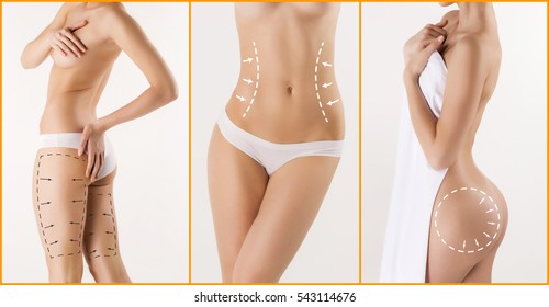 Body correction with the help of plastic surgery on white background