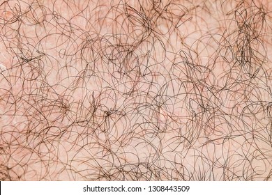 Body Hair Close-up. Hairy Background. Fragment Of Human Hair Covering The Pink Skin.