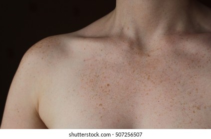 Freckle Chested