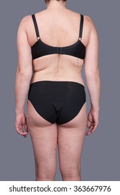 BODY Women After Childbirth, Markings On The Body Liposuction, Excess Fat Woman On Gray Background.Female Body With Underwear, Without Photoshop, Obesity, Stretch Marks,  Wrinkles On His Stomach.