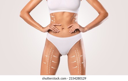 Bodycare And Sculpting Concept. Closeup Cropped View Of Young Female Model In White Top Bra And Panties Posing With Massage Lines And Arrows On Her Belly And Legs, Isolated On White Studio Background