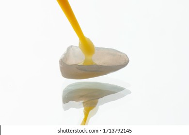 Bonding procedure of preparing porcelain laminated veneer before installation in patient mouth, close up dental photography with white background. - Shutterstock ID 1713792145
