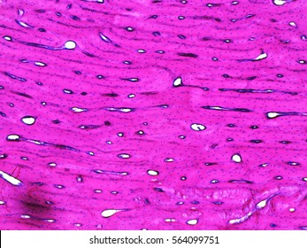 Bone Tissue