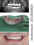 Bone-integrated dental implant treatment with jaw surgery in dental dentistry. Full-arch dental prosthesis for an edentulous jaw. Dental before and after, smile makeover.







