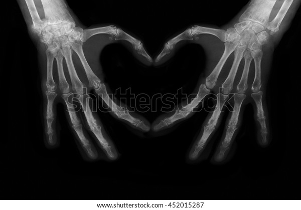 Bones of hands making\
the sign of love