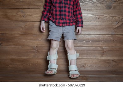 Boot Child’s Walker. Foot Braces, Foot Compression Sleeve. Ankle Brace - Aircast Flat Foot PTTD Brace. Rehabilitation At Home. Valgus Deformity Of Legs. Orthotics Measurment.