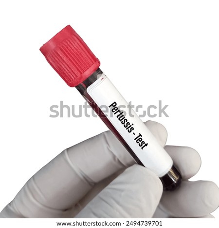 Bordetella pertussis is a bacterium causing whooping cough, a highly contagious respiratory disease. It produces toxins that damage airways, leading to severe coughing fits, especially in infants.



