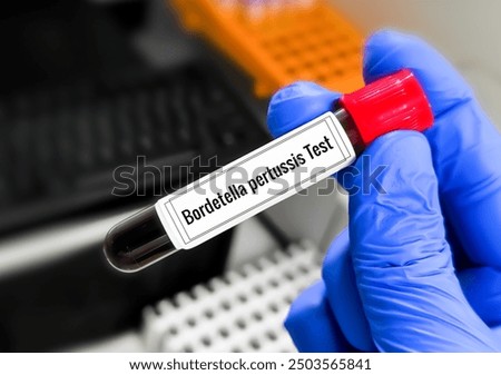 Bordetella pertussis test. Bordetella pertussis is a bacterium causing whooping cough