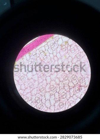 Botany slide: Microscopic view of the lower epidermis showing numerous elliptical stomata.