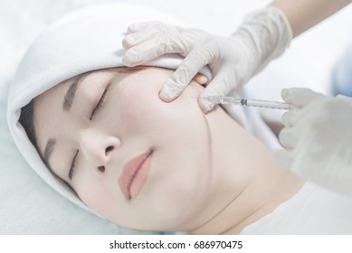 Botox Injection On The Cheek To Change The Face Shape.