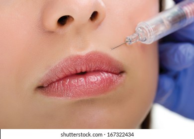 Botox Shot In The Female Cheek,close Up