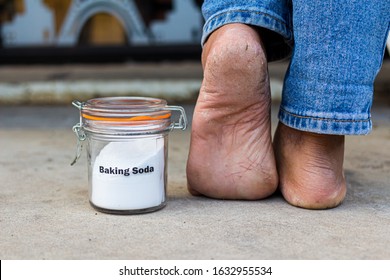 Bottle Of Baking Soda Near The Heel Cracked Health And Beauty Concepts