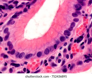 Bottom Of A Gastric Pit Lined By The Surface Epithelium Of The Stomach, Formed By Mucous-secreting Cells Called Foveolar Cells.