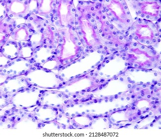 Boundary Between Renal Cortex And Medulla. Periodic Acid Schiff (PAS) Method. On Top, Proximal Convoluted Tubules With Brush Border. On Bottom Distal Contoured Tubules Without Brush Border