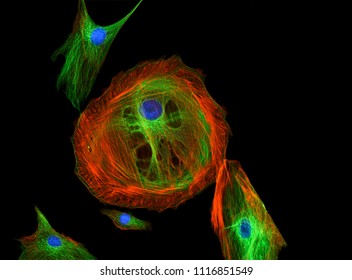 Bovine Pulmonary Artery Endothelial Cells (BPAE) stained for mitochondria, phalloidin and nuclei viewed under a Fluorescent Microscope