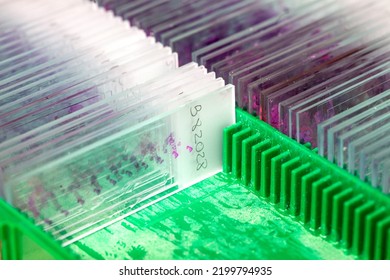 Box Of Stained Tissue Biopsy Glass Slides In Pathology Laboratory