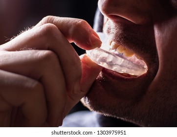 Boxer Teeth Protection. Mouthguard