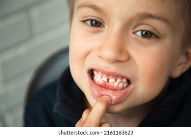 Seven-mouth Images, Stock Photos & Vectors | Shutterstock