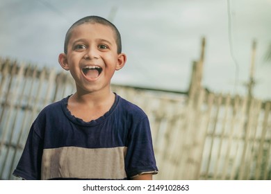 A Boy With A Cute And Beautiful Smile. Bald Kid Smiling After Joining The School