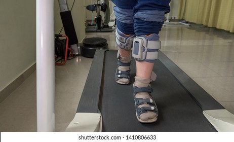 Boy with foot drop system exercising on the treadmill. View to the feet. Treatment with functional electrical stimulation