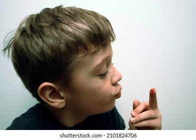boy has injured his finger and shows a trace of a cut and blood
