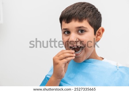 A boy inserts his clear aligner during an orthodontic appointment at the dentist. Concept of dental care for children and orthodontic treatments.