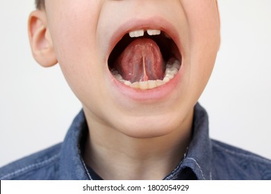 boy, kid opened his mouth, oral cavity, close-up teeth, performs articulation exercises for the tongue, vocals, dental concept, speech therapy