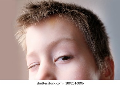 Boy, Kid, Part Of The Face, Funny Eyes Close Up, Looking To The Side, Concept Of A Happy Childhood, Diagnosis, Treatment Of Ophthalmic Diseases, Eyelids, Emotional Development Of Children